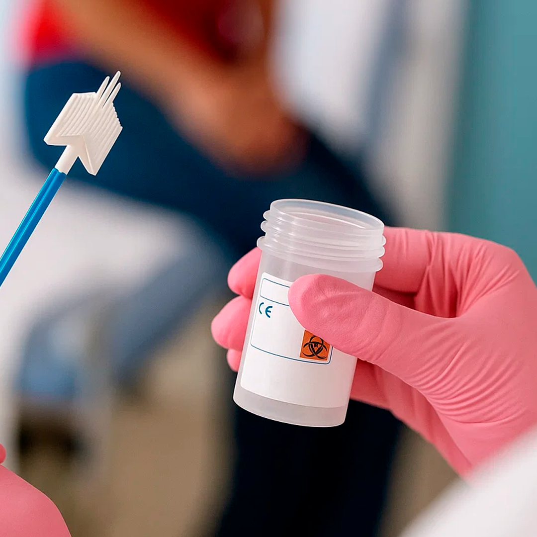 Detección de 14 serotipos de VPH