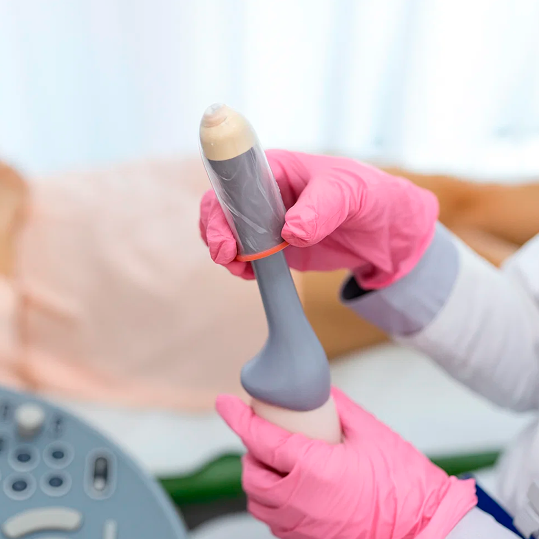 Ecografía Transvaginal Doppler